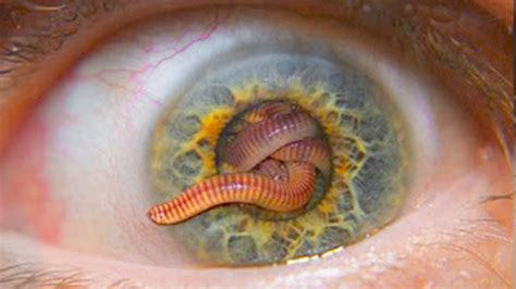  Eyelash Worm: A Master of Regeneration Living a Life of Simplicity!