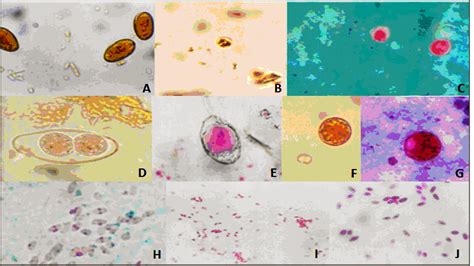  Isospora: Uncovering the Microscopic World of This Sneaky Intestinal Parasite!