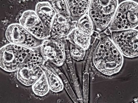  Odontochlamys! This Ciliate with Striking Needle-like Structures Will Amaze You